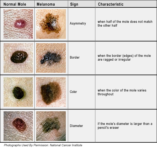 Medical Phase: Skin Cancer